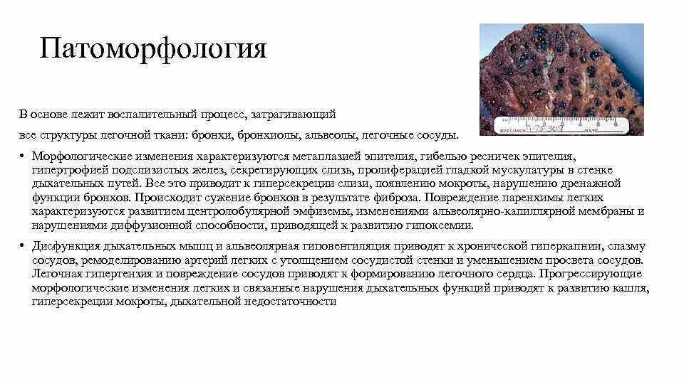 Лежат в основе каждого из. Как называется процесс характеризующий изменения эпителия бронхов. хронический бронхит патофизиология. морфологически хронический бронхит характеризуется. заболевание в основе которого лежит воспалительный процесс.