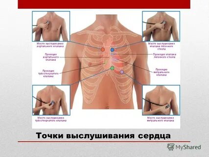 Аускультация сердца точки