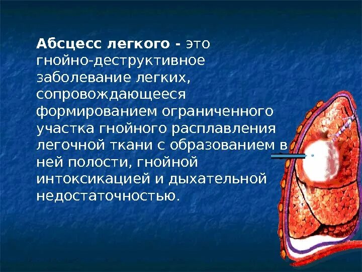 Причины развития абсцесса легкого. Абсцесс легких презентация. Гнойный синдром