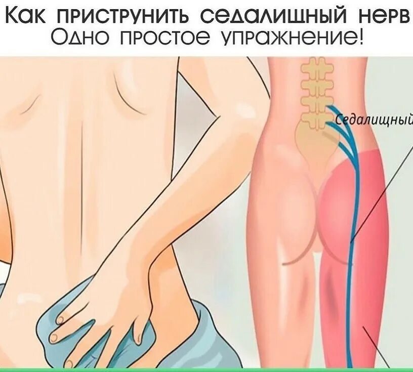 Сильные боли седалищных