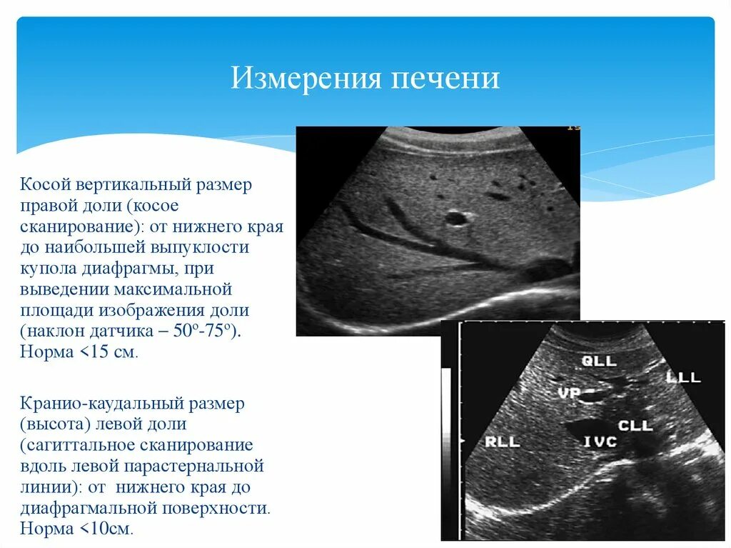 Размеры печени по узи норма