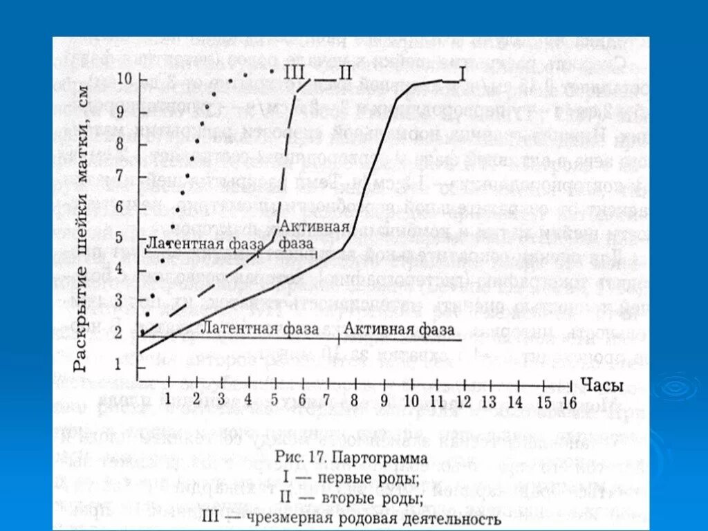 Латентная фаза родов. Чрезмерная родовая деятельность партограмма. Аномалии родовой деятельности партограмма. Партограмма нормальной родовой деятельности. Первичная слабость родовой деятельности партограмма.