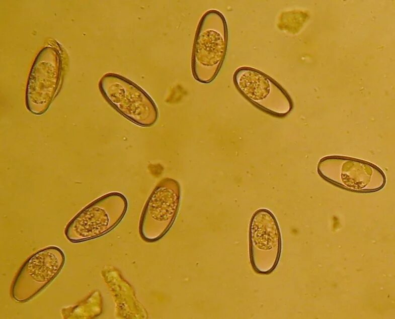 Кокцидии эймерии. Яйца гельминтов микроскопия. Кокцидии изоспор.
