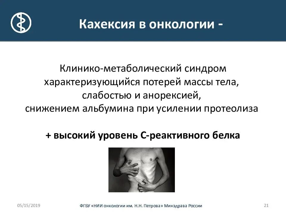 Ожирение первой степени. Снижение веса при онкологии. Рефрактерная кахексия. Имт степени ожирения. Потеря веса при онкологии.