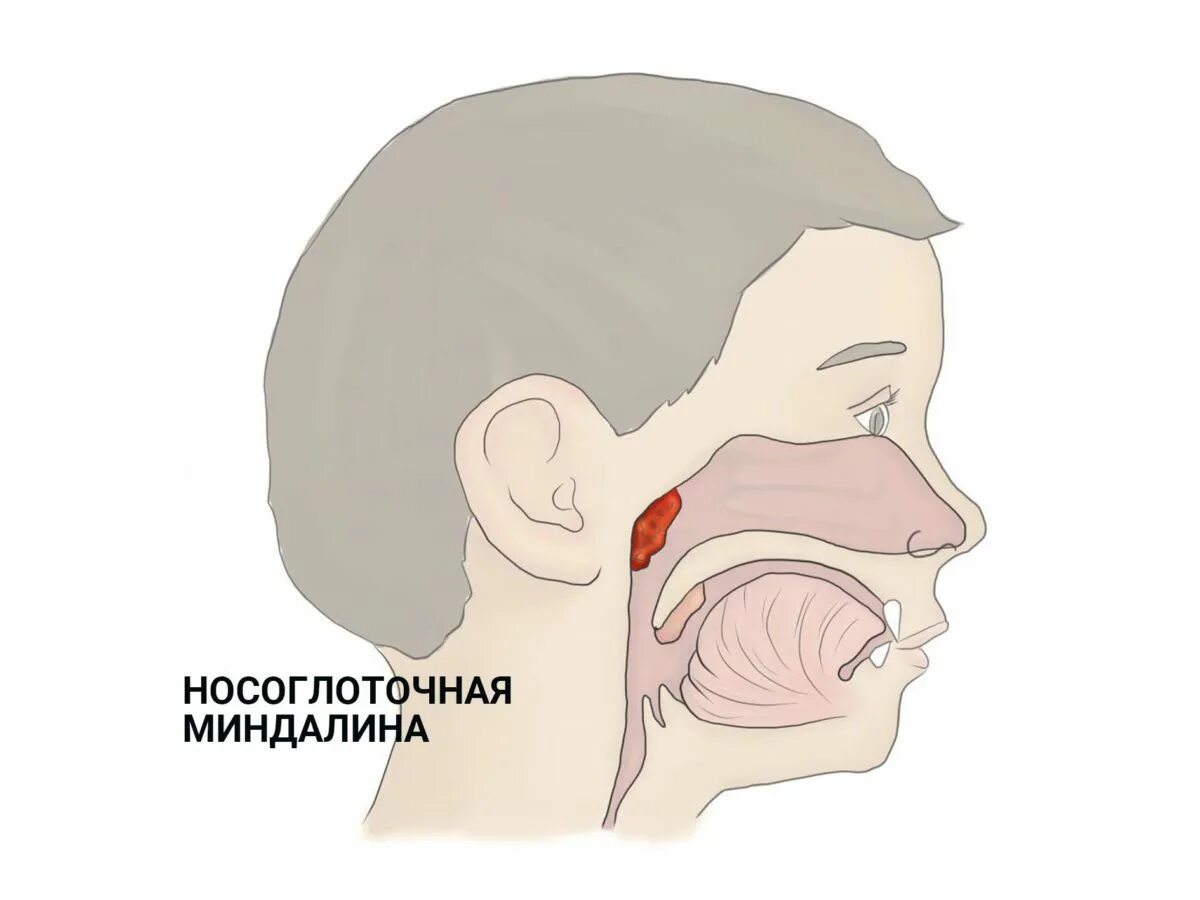 Аденоиды признаки. Миндалины аденоиды анатомия. Анатомия ЛОР органов аденоиды. Носоглоточная миндалина.