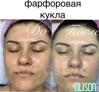 Фарфоровая кукла процедура до и после фото