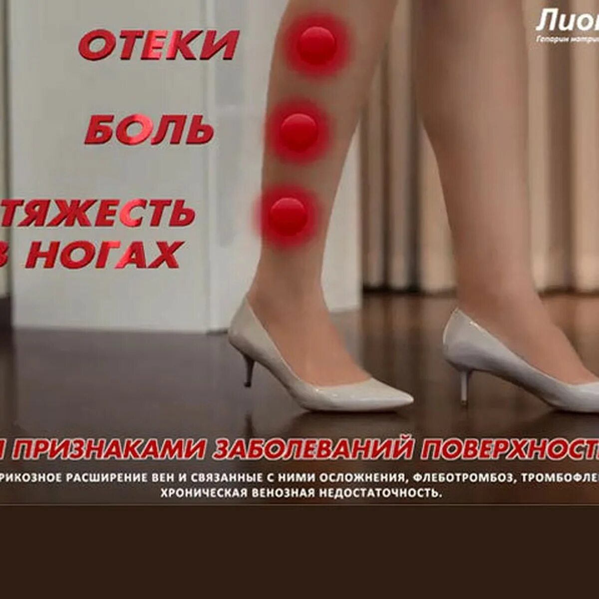 Ноги тяжелые свинцовые. Варикоз причины и симптомы. Болят ноги тяжесть в ногах. Тяжесть в ногах причины у женщин лечение. Спазмы в конечностях причины.