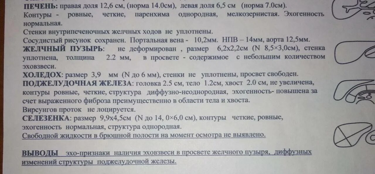 Показатели печени при УЗИ норма. Исследование печени УЗИ норма. УЗИ печени Результаты нормы. Печень УЗИ расшифровка норма у взрослых.