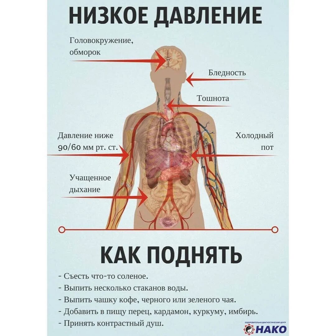 Низкое давление симптомы. Пониженное давление прич. Признаки низкого давления. Проявления пониженного давления. Что делать если сильное давление