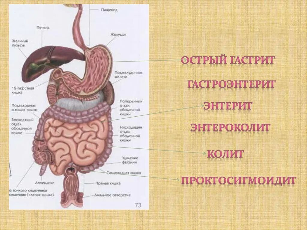 Острый гастроэнтерит формы. Острый энтерит презентация.