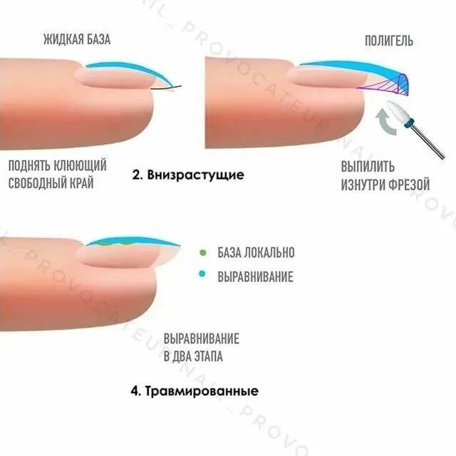 Что нужно перед наращиванием. Правильная форма ногтя вид сбоку. Схема выравнивания ногтевой пластины гелем. Правильная форма нарощенных ногтей вид сбоку. Выравнивание ногтей сбоку.