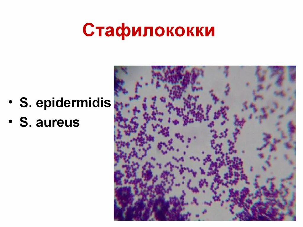 Стафилококкус ауреус микроскопия. Стафилококк эпидермис. Стафилококк ауреус микроскопия. Стафилококк ауреус и эпидермидис. Staphylococcus aureus 10 5