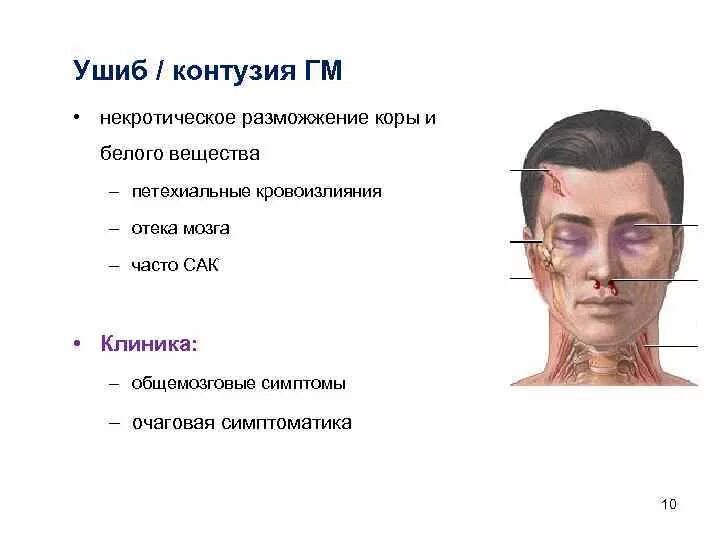 Сотрясение глаза. Симптомы контузии головы. Ушибленная травма головы.