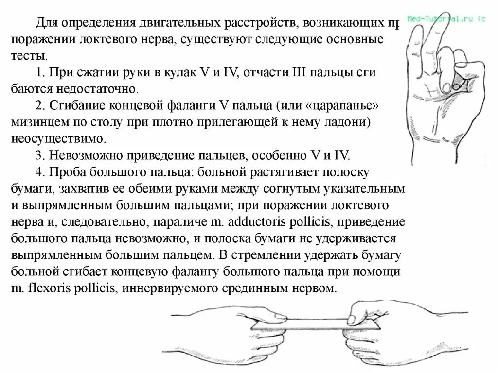 Больно разогнуть палец. При поражении локтевого нерва. Поражение локтевого нерва пробы. Кисть при поражении локтевого нерва. Проба большого пальца.