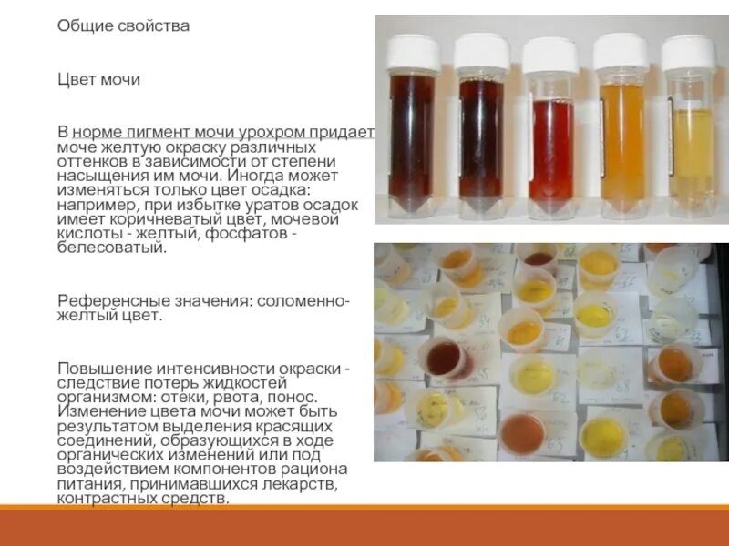 Почему темнеет моча