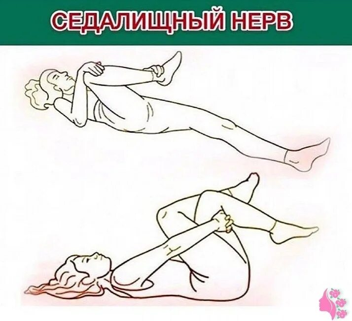Седалищный нерв слева. Седалищный нерв. схема седалищного нерва у человека. седалищный нерв расположение рисунок. ход седалищного нерва.