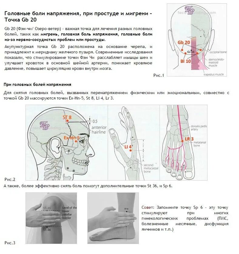 Головная боль напряжения это. Локации головной боли схема. Механизм образования болей при мигрени. Головная боль локализация. Головная боль напряжения.