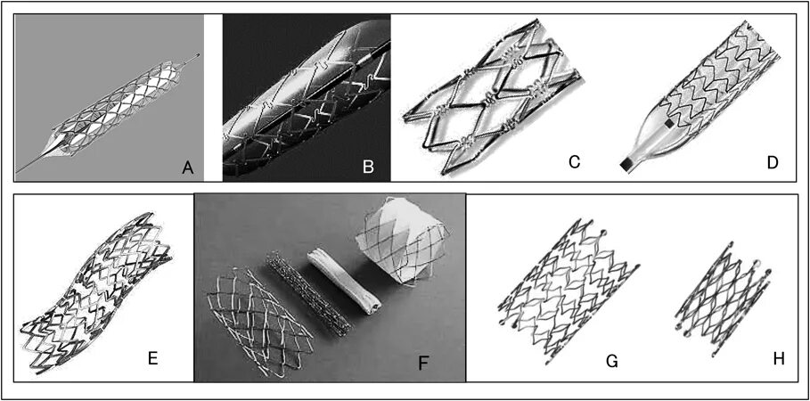 Стент виды. Металлический стент. Типы стентов. Стенты с лекарственным покрытием.