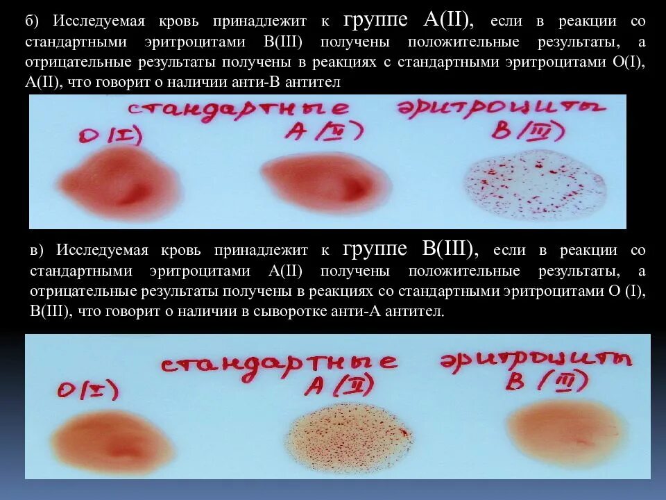 Стандартные эритроциты. 0 резус-фактор крови золотая кровь. группы крови эритроциты. как выглядит группа крови и резус фактор. эритроциты 3 группы крови.