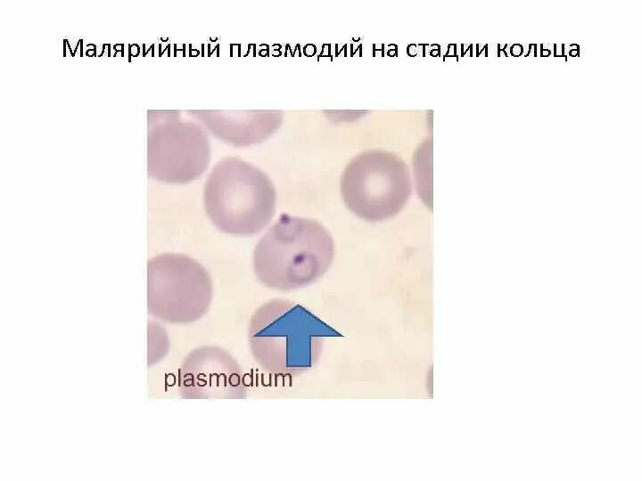 Plasmodium Vivax на стадии кольца. Шизонт малярийного плазмодия строение. Малярийный плазмодий кольцевидный трофозоит строение. Амебовидный трофозоит малярийного плазмодия. Шизонт это