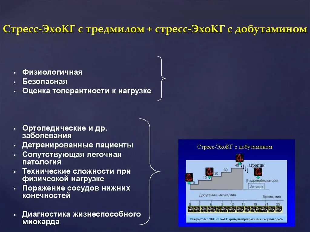 Стресс с добутамином