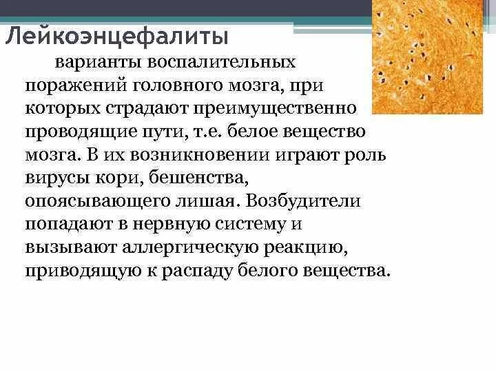 Лейкоэнцефалит. Лейкоэнцефалит ван богарта. подострый склерозирующий лейкоэнцефалит ван-богарта. лейкоэнцефалит шильдера. лейкоэнцефалиты клиника.