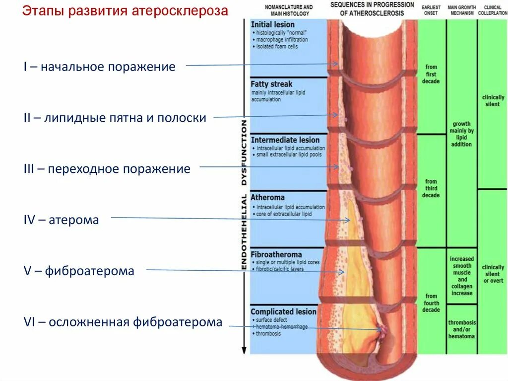 Атеросклероз 1 стадии. Стадии атеросклероза долипидная стадия. атеросклероз периоды развития. атеросклероз этапы атерогенеза. периоды и стадии развития атеросклероза.