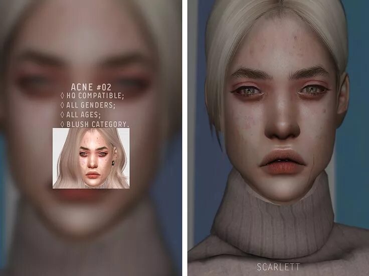 Симс 4 акне. SIMS 4 acne Skin. Симс 4 прыщи. Симс 4 прыщи мод. Как убрать прыщи у симов