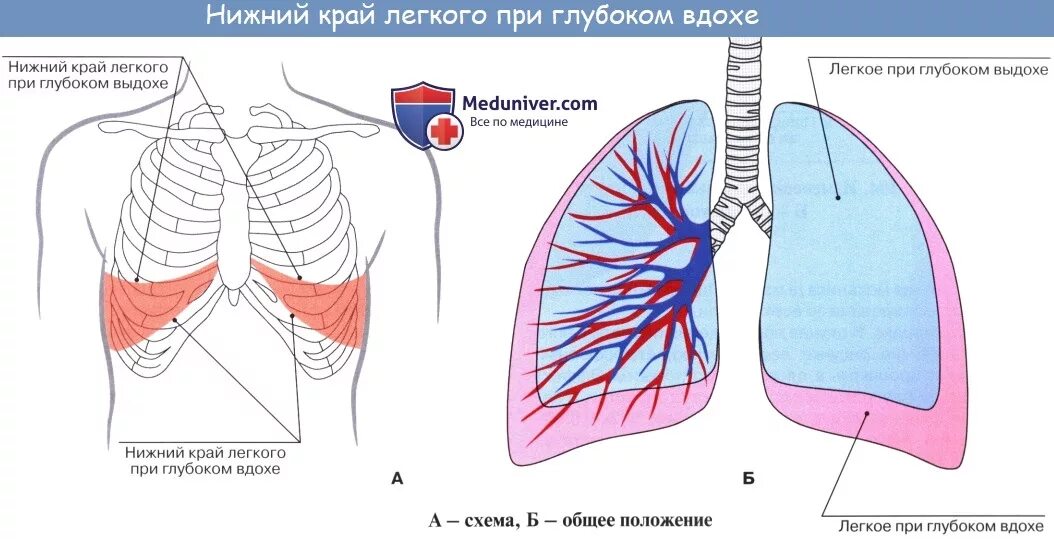 Боль в легком слева