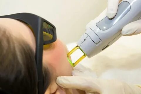 افضل جهاز ليزر لازالة الشعر في العيادات - انواع اجهزة الليزر Laser hair rem...