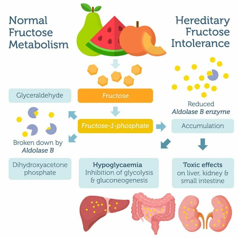 Фруктозурия симптомы. Эссенциальная фруктозурия. Фруктозурия картинки. Fructose Test. Фруктоза и печень