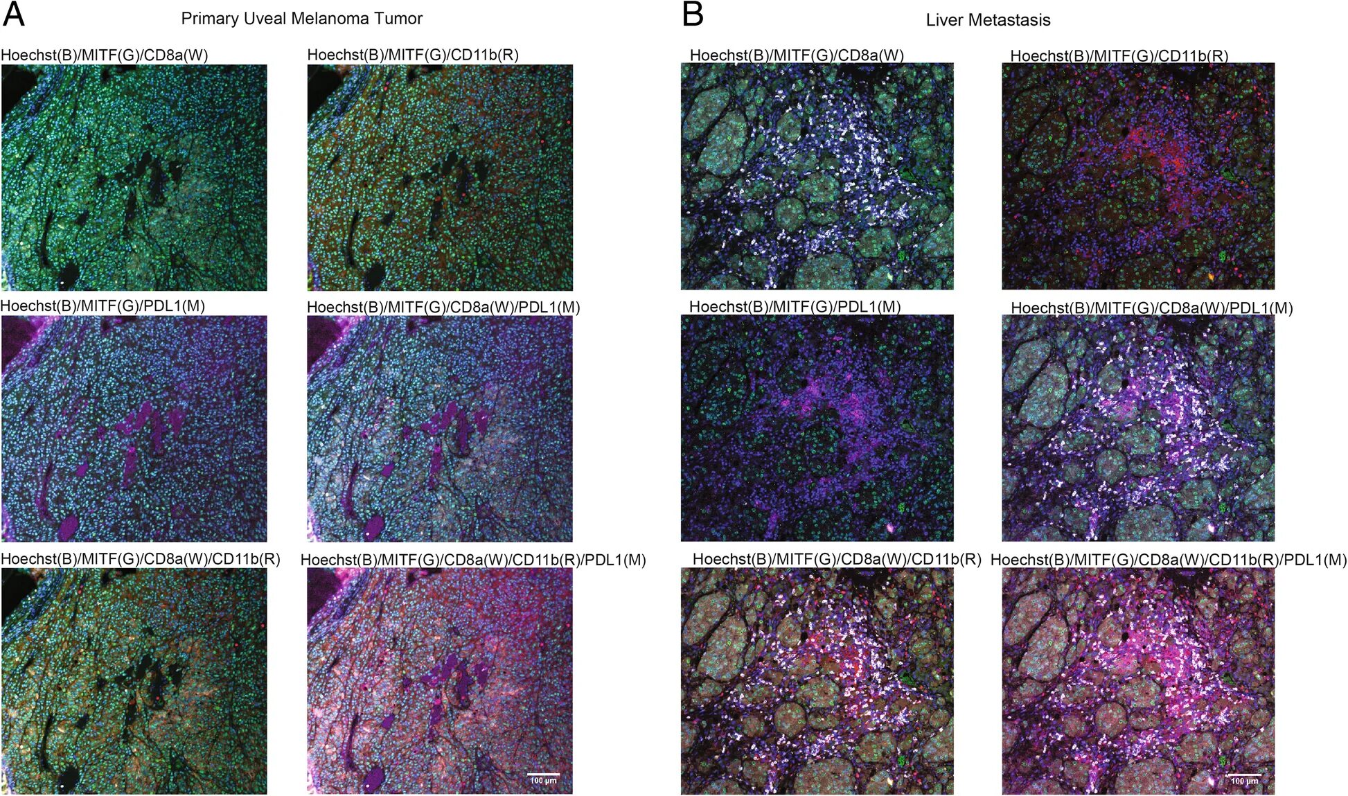 PSGN Immunofluorescence subendothelial. MXIF – multiplexed Immunofluorescence. CD 11 немецкий.