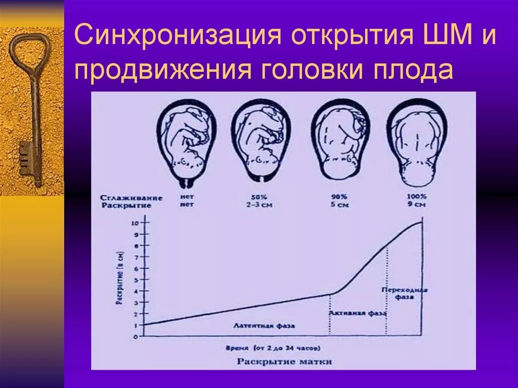 Открытие продвинутая. Продвижение головки плода по родовому каналу. Роды схема продвижение головки. Определение продвижения головки плода.