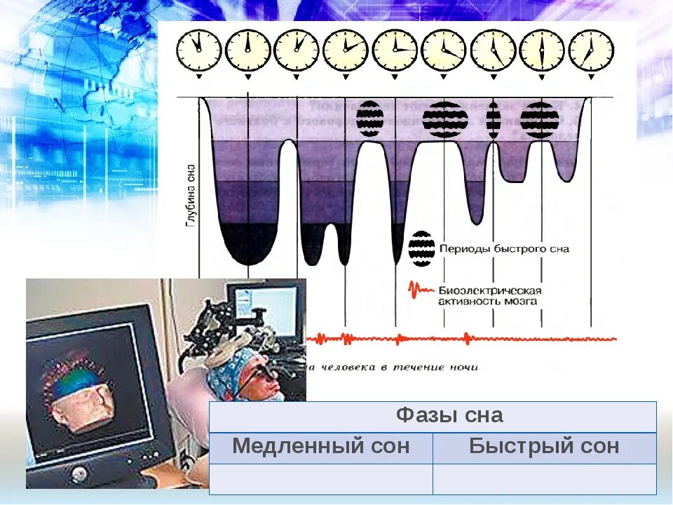 Состоянии быстрого сна. Фаза быстрого сна характеризуется. Быстрый и медленный сон. Фазы сна быстрый и медленный сон. Стадии медленного сна и быстрый сон.