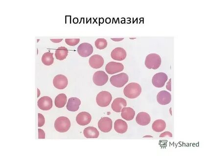 Анизоцитоз это