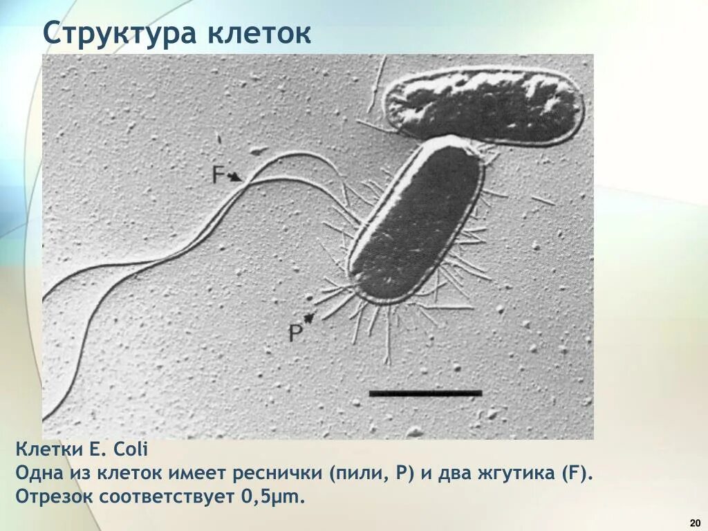Кишечная палочка микрофотография. Escherichia coli микрофотография. Электронная микрофотография клетки кишечной палочки:. Escherichia coli микроскопия. Пили у простейших