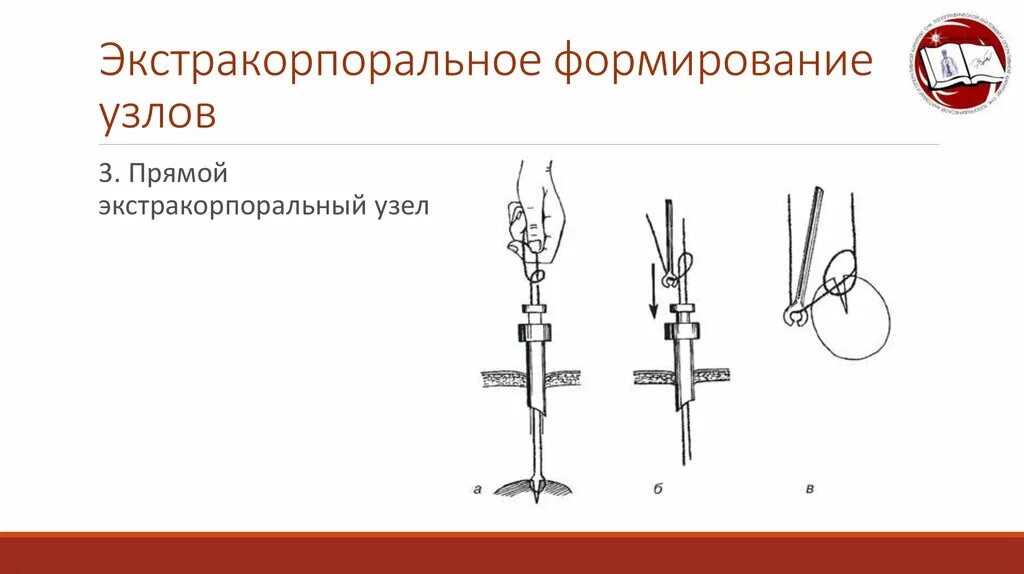 Хирургические узлы техника. Лапароскопический узел редера. Источник развития лимфатических узлов. Фонирование лимфатических узлов. Петля для схватывающего узла прусик.