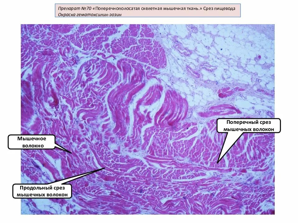 Скелетная мышечная ткань гистология препарат. Исчерченная мышечная ткань препарат. Поперечно-полосатая Скелетная мышечная ткань препарат. Препарат поперечно полосатая мышечная ткань