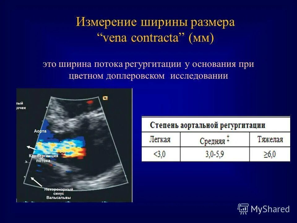 Тк регургитация 1. Эхокардиография аортальная недостаточность. Недостаточность аортального клапана ЭХОКГ. Митральный стеноз ЭХОКГ. Створки митрального клапана на ЭХОКГ.