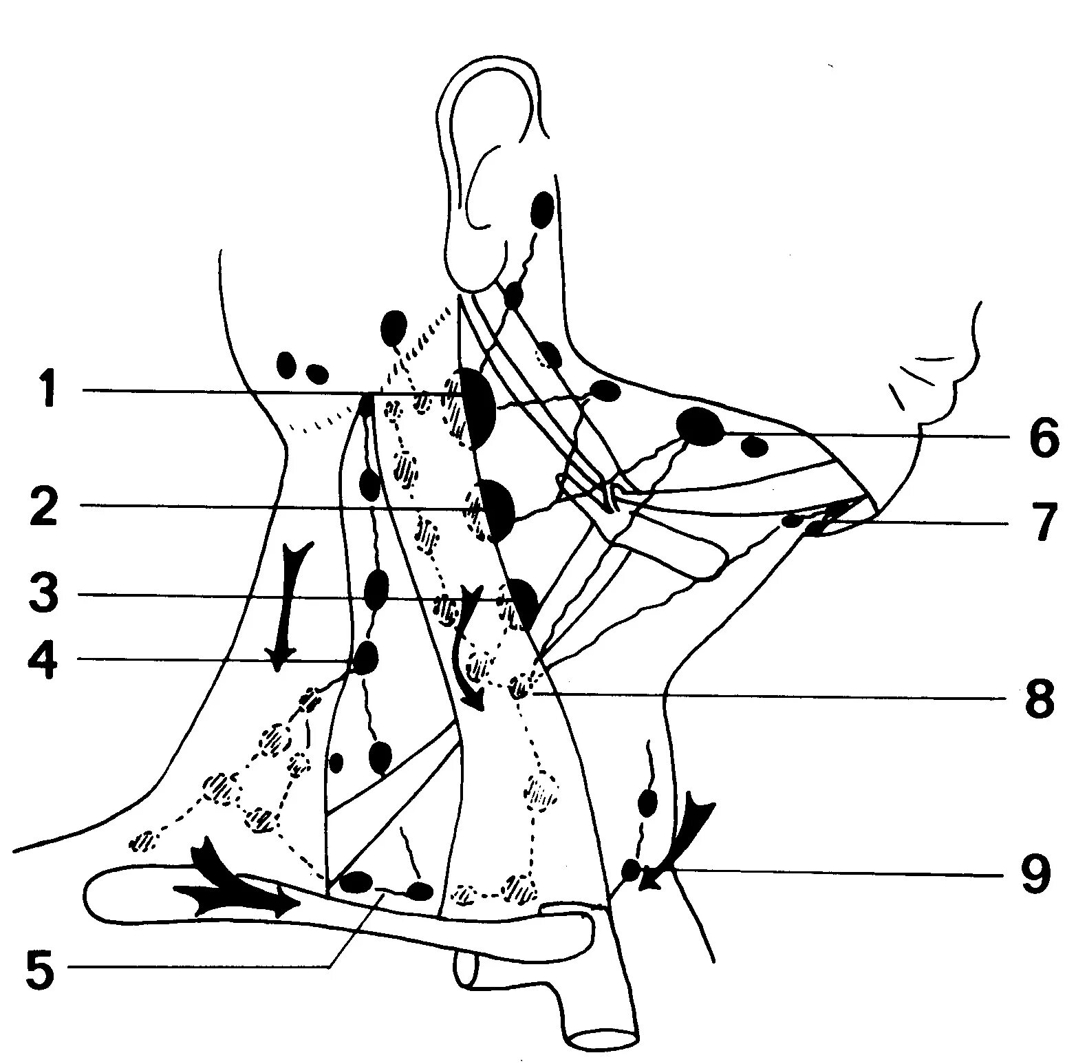 Шейные лимфоузлы слева. Регионарные шейные лимфоузлы. Шейные лимфатические узлы схема. Шейные лимфоузлы топография. Надключичные лимфоузлы схема.