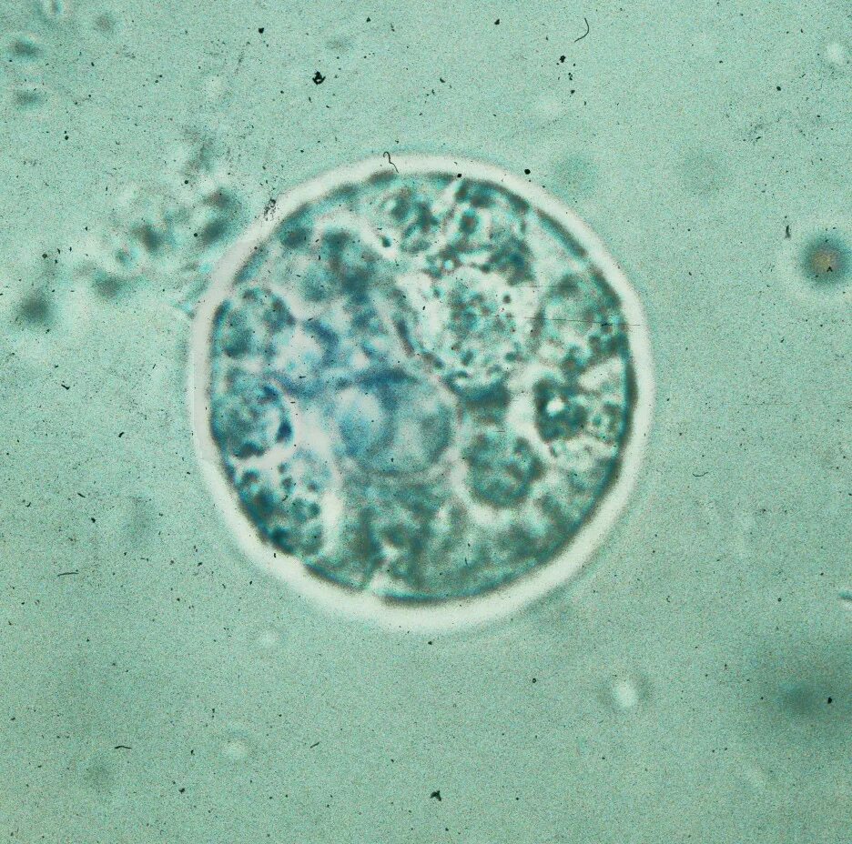 Macrophages
