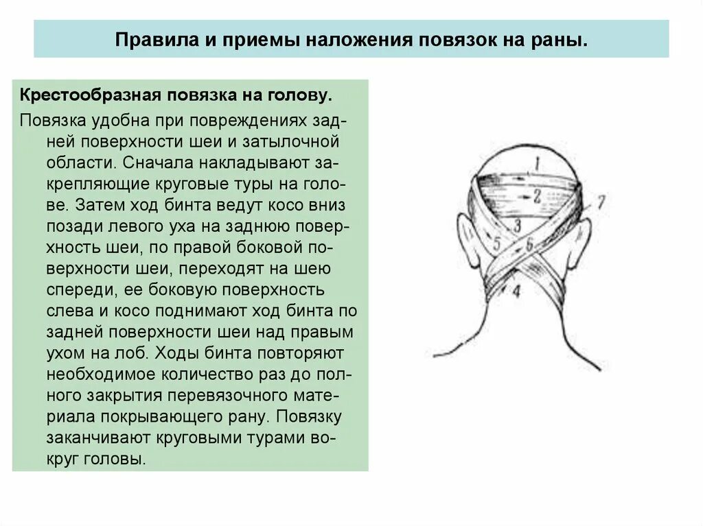 Повреждение затылка какая повязка. При травмах затылка накладывается повязка:. Наложение повязки при травме затылочной части головы. Повязка при травме затылка. Наложение повязки при ранении головы.