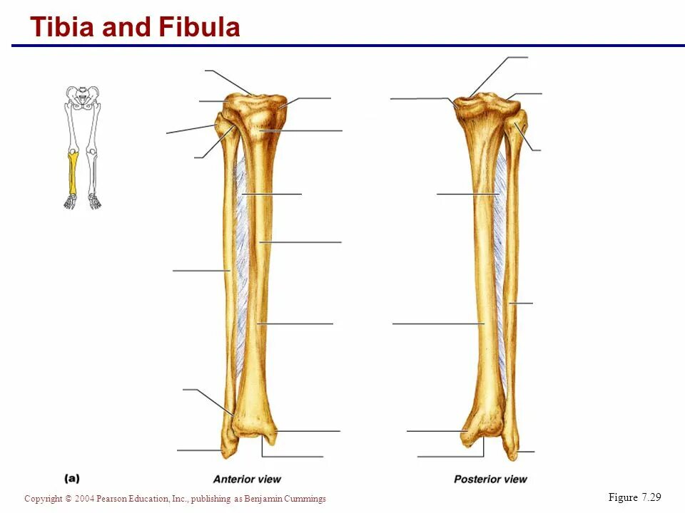 Curved tibia fibula. Curved tibia fibula