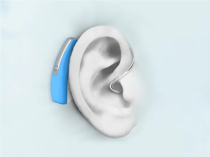Инвалидность по слуху взрослому. Инвалиды по слуху. Слух Минимализм. Инвалидность слух аппарат. Устройства для слабослышащих на белом фоне.