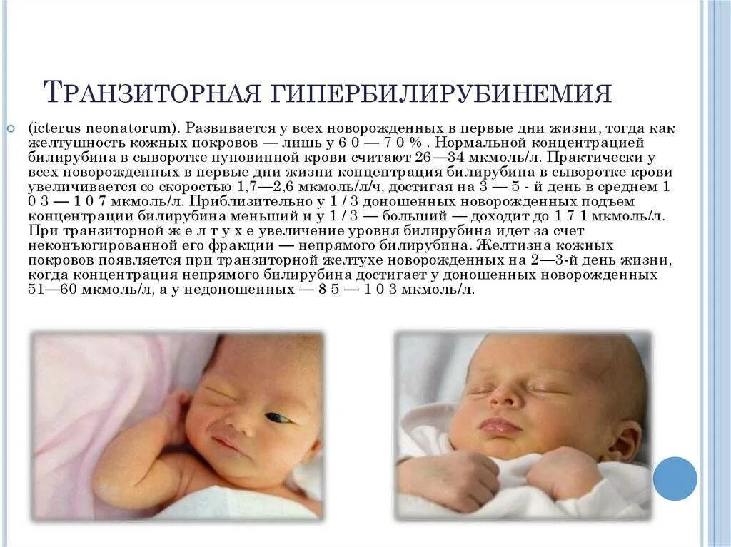 Повышенный билирубин у ребенка причины. Физиологическая желтушка у новорожденных норма. физиологическая желтуха новорожденных билирубин. транзиторное состояние новорожденных желтуха. новорожденный ребенок с желтушкой.