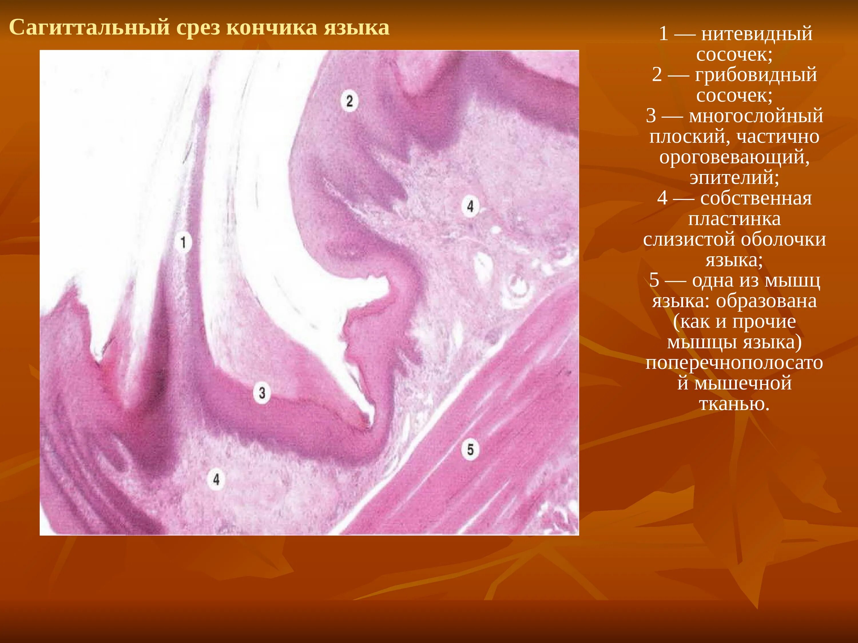 Вырост слизистой оболочки. Язык гистология препарат. Сагиттальный срез кончика языка. Нитевидные сосочки языка. Собственная пластинка слизистой оболочки языка.