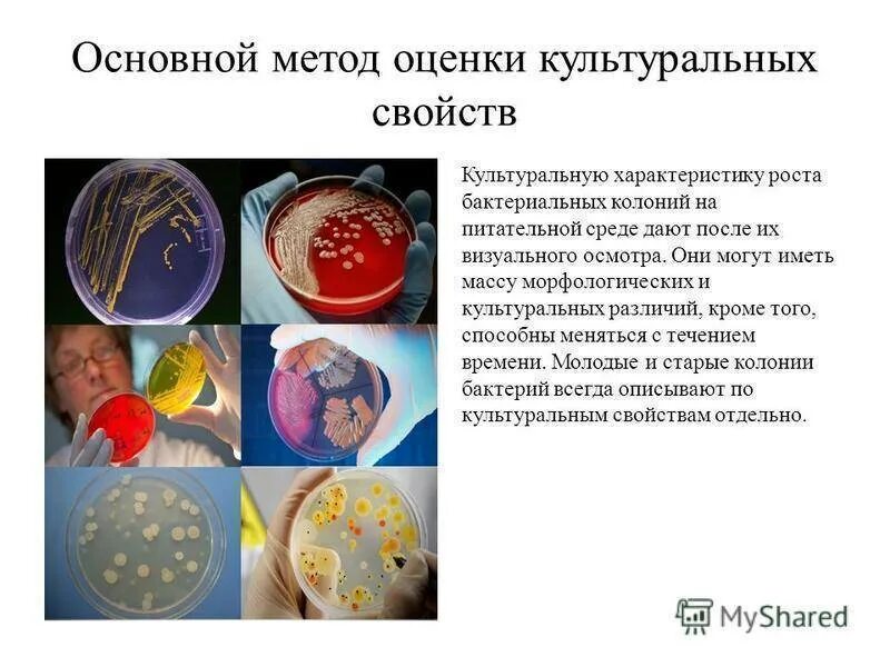 Определение свойств бактерий. Культуральные признаки микроорганизмов. Характеристика колоний бактерий. Культуральные свойства микроорганизмов. Культуральные свойства бактерий.