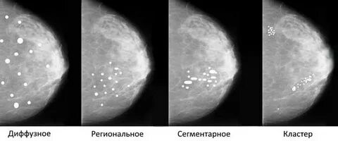 Фам молочных желез
