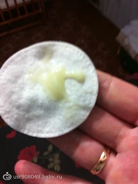 Отошла слизистая пробка. Слизислизистая пробка. Какого цвета бывает пробка. Желтоватые тягучие выделения. Прозрачный сгусток слизи.