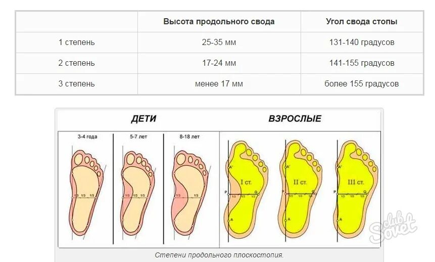 Плоскостопие 3 степени сколько градусов. Оценка поперечного свода стопы формула. Оценка продольного свода стопы формула. Высота свода плоскостопие 2 степени. Поперечное плоскостопие таблица.